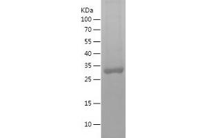 Western Blotting (WB) image for Sulfotransferase Family, Cytosolic, 2A, Dehydroepiandrosterone (DHEA)-Preferring, Member 1 (SULT2A1) (AA 200-285) protein (His-IF2DI Tag) (ABIN7282837) (SULT2A1 Protein (AA 200-285) (His-IF2DI Tag))