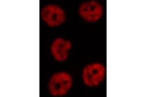 ABIN6274751 staining Hela cells by IF/ICC. (RPS19 抗体  (Internal Region))