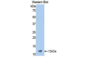 Western Blotting (WB) image for anti-Vitronectin (VTN) (AA 400-468) antibody (ABIN1860949) (Vitronectin 抗体  (AA 400-468))
