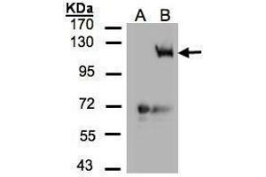 WB Image Western Blot analysis of PIK3CG expression in transfected 293T cell line by PIK3CG polyclonal antibody.