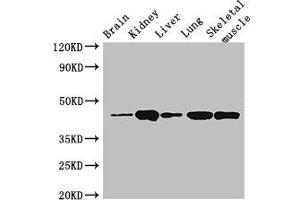 Western Blot Positive WB detected in: Mouse brain tissue, Mouse kidney tissue, Mouse liver tissue, Rat lung tissue, Rat skeletal muscle tissue All lanes: P2RX4 antibody at 3 μg/mL Secondary Goat polyclonal to rabbit IgG at 1/50000 dilution Predicted band size: 44, 46, 41 kDa Observed band size: 44 kDa (P2RX4 抗体  (AA 91-176))