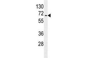 S6K2 antibody western blot analysis in Jurkat lysate (RPS6KB2 抗体)