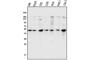 Western blot analysis of CCNE1 using anti-CCNE1 antibody (ABIN7601193).