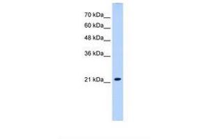 Image no. 1 for anti-Solute Carrier Family 25 (Mitochondrial Carrier, Brain), Member 14 (SLC25A14) (AA 51-100) antibody (ABIN320836)