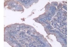 Immunohistochemistry (IHC) image for anti-Serpin Family C Member 1 (SERPINC1) (AA 33-465) antibody (ABIN7444769)