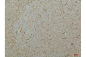 Immunohistochemical analysis of paraffin-embedded Mouse Brain Tissue using Cav1. (CACNA1D 抗体)