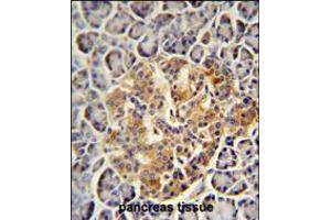 PRSS3 antibody immunohistochemistry analysis in formalin fixed and paraffin embedded human pancreas tissue followed by peroxidase conjugation of the secondary antibody and DAB staining. (PRSS3 抗体  (N-Term))