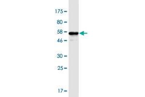 Western Blotting (WB) image for anti-Acidic (Leucine-Rich) Nuclear phosphoprotein 32 Family, Member B (ANP32B) (AA 1-251) antibody (ABIN948954)