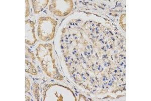Immunohistochemistry (IHC) image for anti-Propionyl CoA Carboxylase beta Polypeptide (PCCB) antibody (ABIN1876603) (PCCB 抗体)