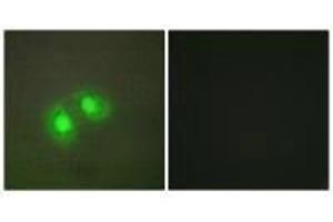 Immunofluorescence analysis of A549 cells, using TOP2A antibody. (Topoisomerase II alpha 抗体  (N-Term))