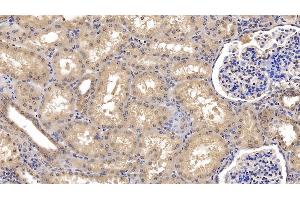 Detection of Ub in Human Kidney Tissue using Monoclonal Antibody to Ubiquitin (Ub) (Ubiquitin 抗体  (AA 1-229))