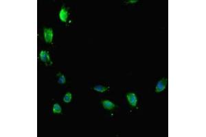 Immunofluorescent analysis of Hela cells using ABIN7172767 at dilution of 1:100 and Alexa Fluor 488-congugated AffiniPure Goat Anti-Rabbit IgG(H+L) (ATRX 抗体  (AA 2161-2443))