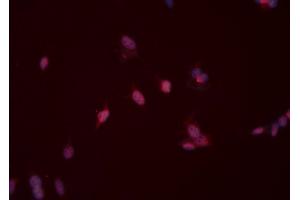 ABIN6276526 staining HeLa cells by ICC/IF. (MSH2 抗体  (C-Term))