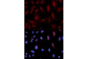 Immunofluorescence analysis of U2OS cell using PLCB1 antibody. (Phospholipase C beta 1 抗体  (AA 917-1216))