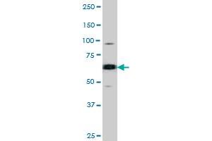 The CDC25B (phospho S187) polyclonal antibody  is used in Western blot to detect Phospho-CDC25B-S187 in SK-BR-3 cell lysate (CDC25B 抗体  (pSer187))