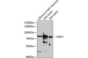 Western blot analysis of extracts of various cell lines, using SNPH antibody (ABIN6128797, ABIN6148202, ABIN6148203 and ABIN6215909) at 1:1000 dilution. (Syntaphilin 抗体  (AA 300-425))