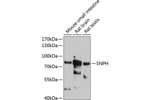 Syntaphilin Antikörper  (AA 300-425)