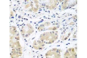 Immunohistochemistry of paraffin-embedded Human stomach using EIF3A Polyclonal Antibody at dilution of 1:100 (40x lens). (EIF3A 抗体)