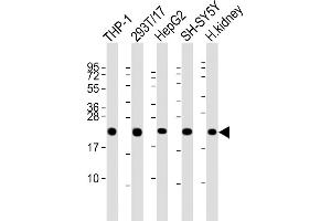 All lanes : Anti-GPX1 Antibody (C-term) at 1:2000 dilution Lane 1: THP-1 whole cell lysate Lane 2: 293T/17 whole cell lysate Lane 3: HepG2 whole cell lysate Lane 4: SH-SY5Y whole cell lysate Lane 5: human kidney lysate Lysates/proteins at 20 μg per lane. (Glutathione Peroxidase 1 抗体  (C-Term))