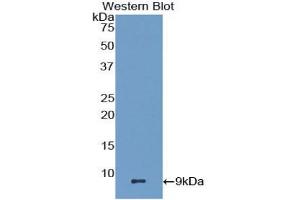 Western blot analysis of the recombinant protein. (CCL22 抗体  (AA 29-92))
