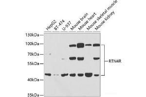 Western blot analysis of extracts of various cell lines using RTN4R Polyclonal Antibody at dilution of 1:1000. (RTN4R 抗体)