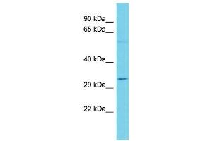 Host: Rabbit Target Name: OR7A5 Sample Type: Jurkat Whole Cell lysates Antibody Dilution: 1. (OR7A5 抗体  (C-Term))