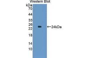 Detection of Recombinant TAK1L, Mouse using Polyclonal Antibody to TAK1 Like Protein (TAK1L) (MAP3K7CL 抗体  (AA 1-142))