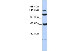WB Suggested Anti-C17orf57 Antibody Titration: 0. (C17orf57 抗体  (N-Term))