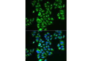 Immunofluorescence analysis of A549 cells using GLUD2 antibody (ABIN5973969). (GLUD2 抗体)