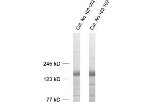 dilution: 1 : 1000, sample: rat brain homogenate (LIPA3 抗体  (AA 313-461))