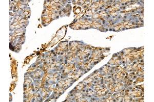 Phospho-eIF4B (Ser504) Antibody at 1/100 staining Rat muscle tissue by IHC-P. (EIF4B 抗体  (pSer504))
