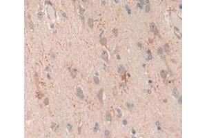 Immunohistochemistry (IHC) image for anti-Neurofilament, Light Polypeptide (NEFL) (AA 281-396) antibody (ABIN1176228)