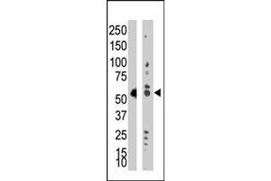 Western blot analysis of TRDMT1 polyclonal antibody  in Jurkat cell lysate (Lane A) and mouse liver tissue lysate (Lane B) . (Dnmt2 抗体  (AA 353-383))