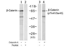 Image no. 1 for anti-Catenin (Cadherin-Associated Protein), beta 1, 88kDa (CTNNB1) (Ser45), (Thr41) antibody (ABIN197274) (CTNNB1 抗体  (Ser45, Thr41))