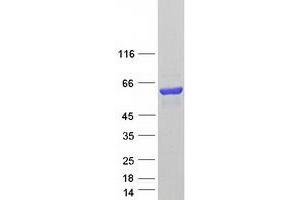 Western Blotting (WB) image for Dystrobrevin alpha (DTNA) (Transcript Variant 6) protein (Myc-DYKDDDDK Tag) (ABIN2719787)