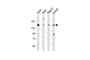All lanes : Anti-CCK4 (PTK7) Antibody (N-term) at 1:1000-1:2000 dilution Lane 1: A431 whole cell lysate Lane 2: Hela whole cell lysate Lane 3: HepG2 whole cell lysate Lane 4: Caco2 whole cell lysate Lysates/proteins at 20 μg per lane. (PTK7 抗体  (N-Term))