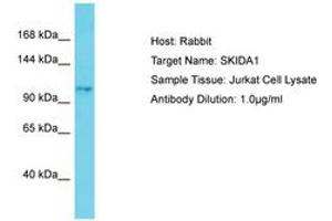 Image no. 1 for anti-SKI/DACH Domain Containing 1 (SKIDA1) (AA 772-821) antibody (ABIN6750805) (SKIDA1 抗体  (AA 772-821))
