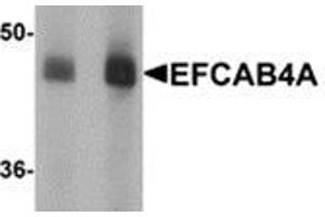 Western blot analysis of EFCAB4A in human lung tissue lysate with EFCAB4A antibody at (A) 1 and (B) 2 μg/ml. (EFCAB4A 抗体  (Center))