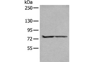 Western blot analysis of A549 and Jurkat cell lysates using ALKBH8 Polyclonal Antibody at dilution of 1:300 (ALKBH8 抗体)