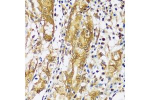 Immunohistochemistry of paraffin-embedded human stomach using CAST antibody  at dilution of 1:100 (40x lens). (Calpastatin 抗体  (AA 1-350))