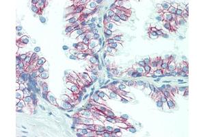 Immunohistochemistry (Paraffin-embedded Sections) (IHC (p)) image for anti-Catenin (Cadherin-Associated Protein), beta 1, 88kDa (CTNNB1) antibody (ABIN1496888)