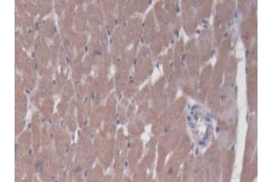 DAB staining on IHC-P; Samples: Rat Heart Tissue (BCAT1 抗体  (AA 179-411))