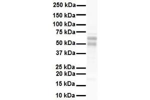 Western Blotting (WB) image for anti-Nuclear Receptor Subfamily 5, Group A, Member 1 (NR5A1) (Middle Region) antibody (ABIN2777447)