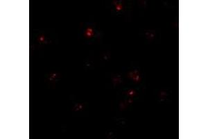 Immunofluorescence of PSENEN in K-562 cells with PSENEN polyclonal antibody  at 20 ug/mL . (PEN2 抗体  (C-Term))