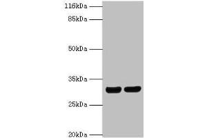 Western blot All lanes: HLA-DRB1 antibody at 2 μg/mL Lane 1: A375 whole cell lysate Lane 2: Raji whole cell lysate Secondary Goat polyclonal to rabbit IgG at 1/10000 dilution Predicted band size: 30 kDa Observed band size: 30 kDa (HLA-DRB1 抗体  (AA 30-266))