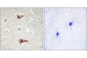 Immunohistochemistry (IHC) image for anti-Potassium Voltage-Gated Channel, Shaker-Related Subfamily, Member 3 (KCNA3) (AA 101-150), (pTyr135) antibody (ABIN1531682)