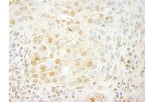 anti-Serine/threonine-Protein Kinase PRP4 Homolog (PRPF4B) (AA 1-50) antibody