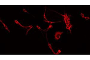 ABIN6266565 staining Hela by IF/ICC. (Integrin beta 5 抗体  (C-Term))