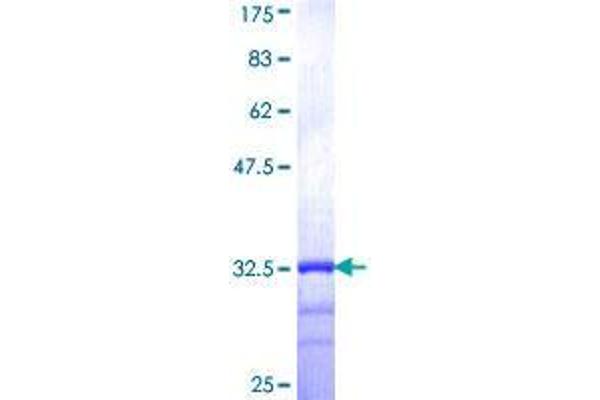 AGTRAP Protein (AA 108-159) (GST tag)