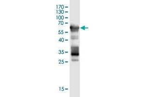 Western Blot detection against Immunogen (59. (SCML4 抗体  (AA 1-305))